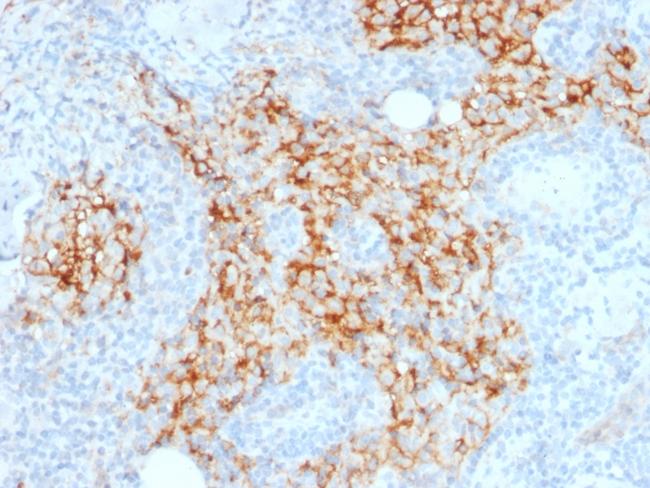 CD14 (Monocyte/Macrophage Marker) Antibody in Immunohistochemistry (Paraffin) (IHC (P))