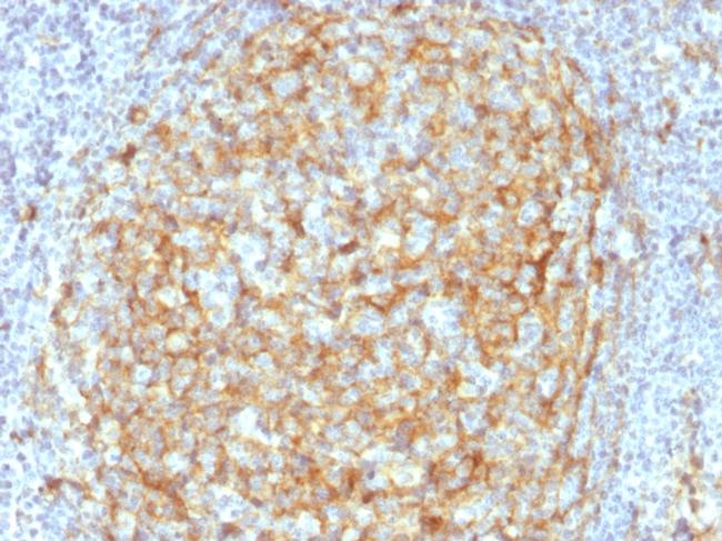 CD14 Antibody in Immunohistochemistry (Paraffin) (IHC (P))