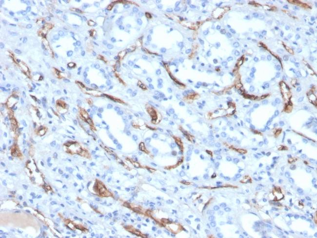 Adiponectin (Marker of Obesity) Antibody in Immunohistochemistry (Paraffin) (IHC (P))