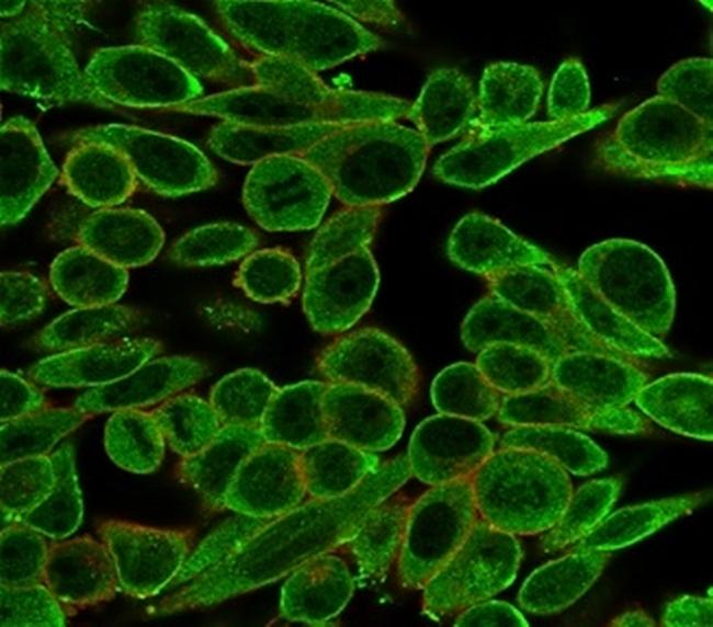 MED21/SRB7 Antibody in Immunocytochemistry (ICC/IF)