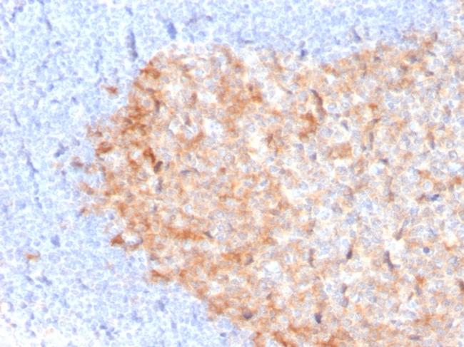 CD86 Antibody in Immunohistochemistry (Paraffin) (IHC (P))