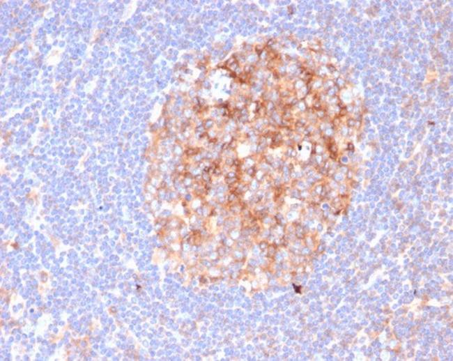 CD86 (Dendritic Cells Maturation Marker) Antibody in Immunohistochemistry (Paraffin) (IHC (P))