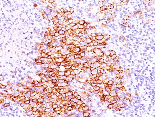 CD30/TNFRSF8 (Hodgkin and Reed-Sternberg Cell Marker) Antibody in Immunohistochemistry (Paraffin) (IHC (P))