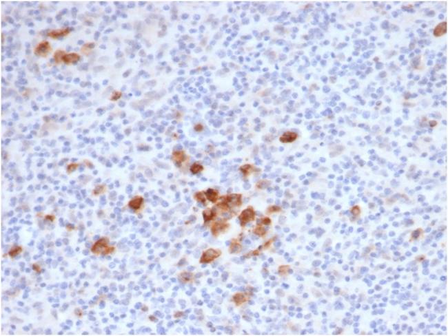 CD30/ TNFRSF8 (Hodgkin andReed-Sternberg Cell Marker) Antibody in Immunohistochemistry (Paraffin) (IHC (P))