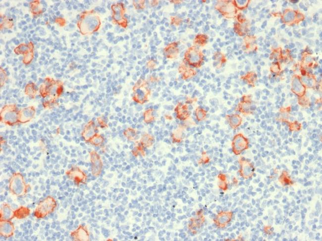 CD30/TNFRSF8 (Hodgkin and Reed-Sternberg Cell Marker) Antibody in Immunohistochemistry (Paraffin) (IHC (P))