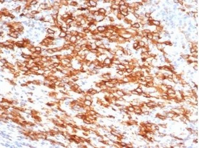 CD30/TNFRSF8 Antibody in Immunohistochemistry (Paraffin) (IHC (P))