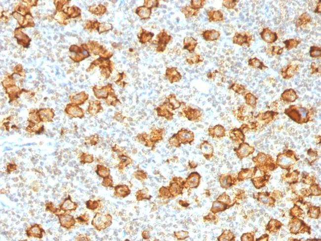 CD30/TNFRSF8 Antibody in Immunohistochemistry (Paraffin) (IHC (P))