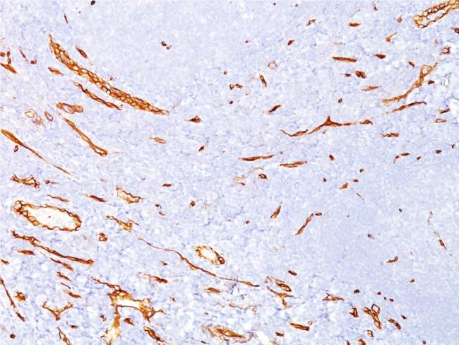 CD34 (Hematopoietic Stem Cell and Endothelial Marker) Antibody in Immunohistochemistry (Paraffin) (IHC (P))