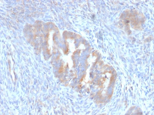 ATG5 Antibody in Immunohistochemistry (Paraffin) (IHC (P))