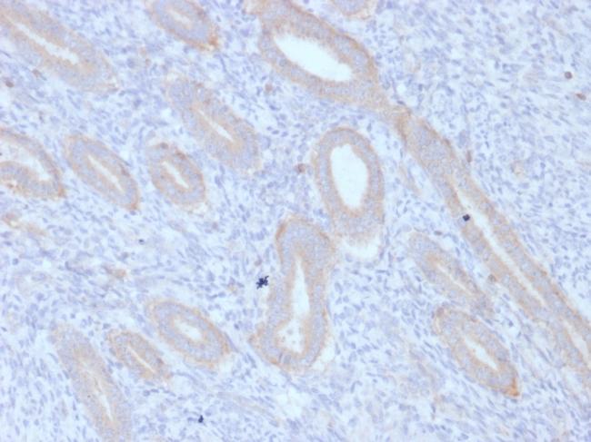 ATG5 Antibody in Immunohistochemistry (Paraffin) (IHC (P))