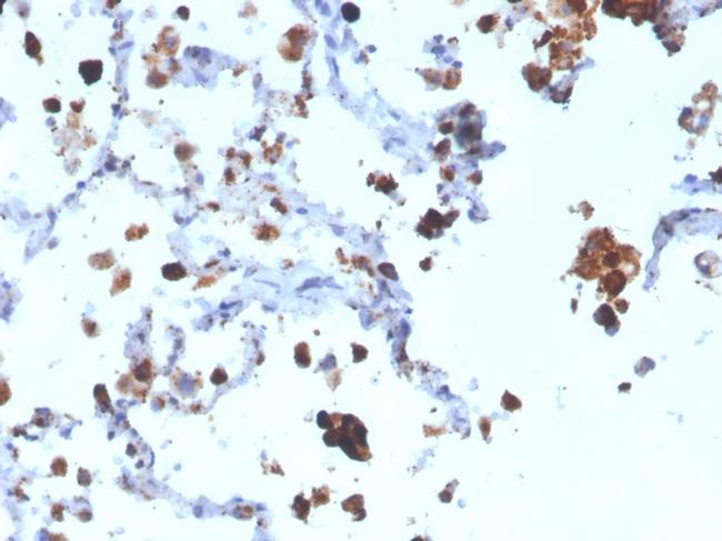 Napsin A Antibody in Immunohistochemistry (Paraffin) (IHC (P))