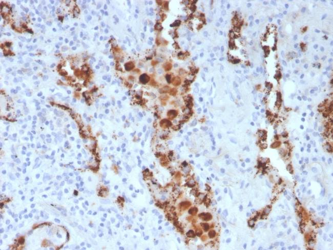 Napsin A (Lung Adenocarcinoma Marker) Antibody in Immunohistochemistry (Paraffin) (IHC (P))