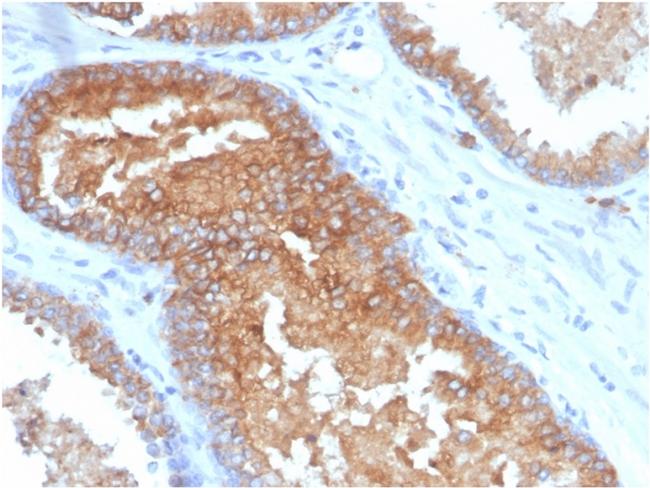 CD38 (ADP Ribosyl Cyclase I) Antibody in Immunohistochemistry (Paraffin) (IHC (P))