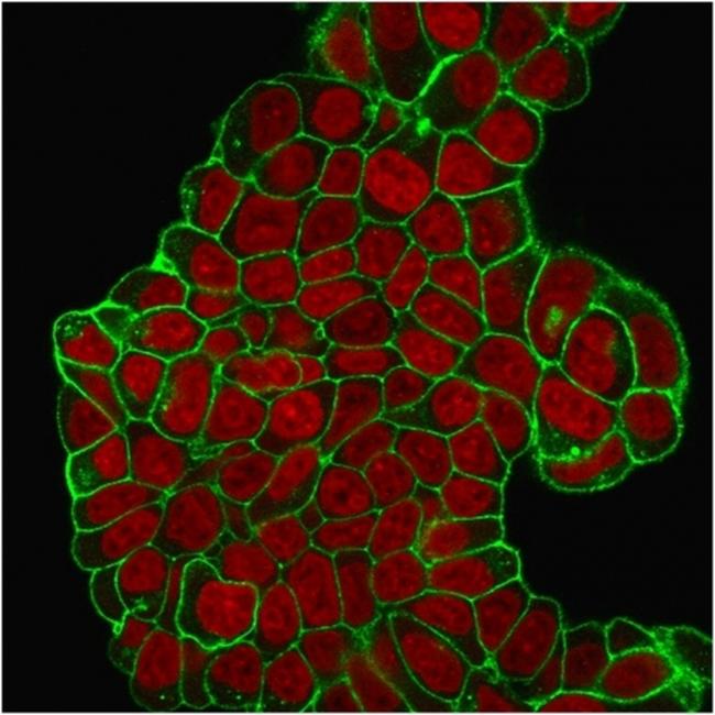 CD47/IAP (Integrin Associated Protein) Antibody in Immunocytochemistry (ICC/IF)