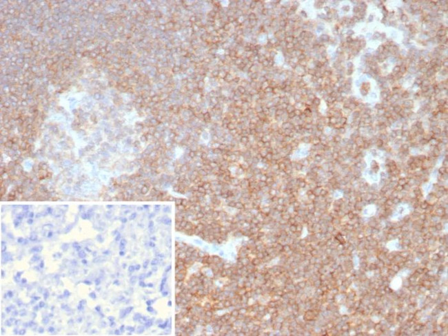 CD48 (Pan Leukocyte Marker) Antibody in Immunohistochemistry (Paraffin) (IHC (P))