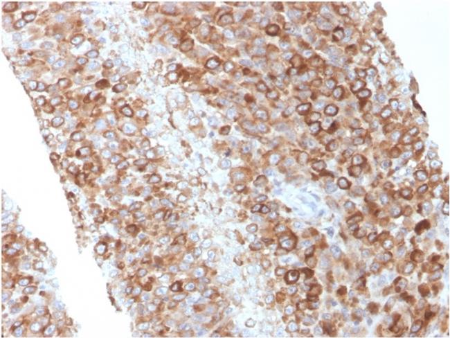 CD63 Antibody in Immunohistochemistry (Paraffin) (IHC (P))