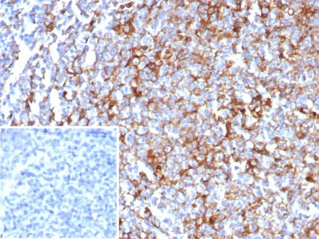 CD63 (Late Endosomes Marker) Antibody in Immunohistochemistry (Paraffin) (IHC (P))