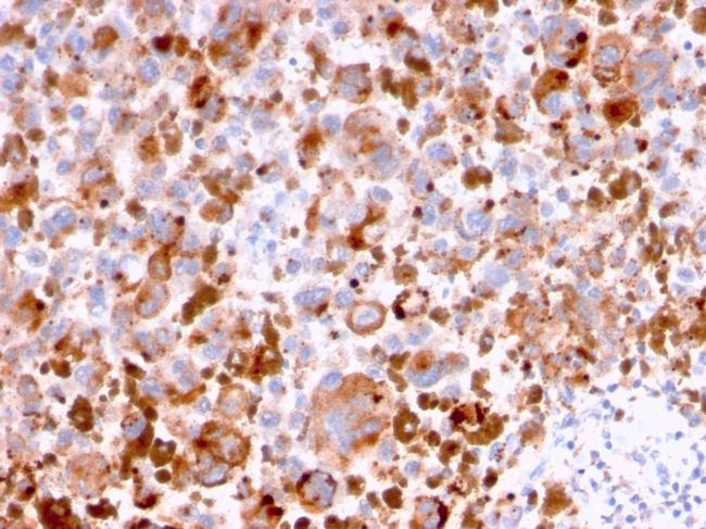 CD63 Antibody in Immunohistochemistry (Paraffin) (IHC (P))