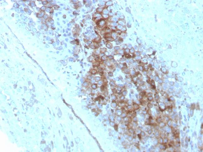 CD63 (Late Endosomes Marker) Antibody in Immunohistochemistry (Paraffin) (IHC (P))