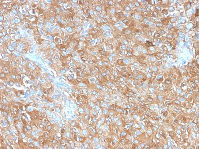 CD63 (Late Endosomes Marker) Antibody in Immunohistochemistry (Paraffin) (IHC (P))