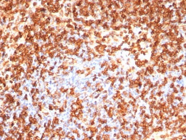 CD74 (B-Cell Marker) (Transcription Regulator) Antibody in Immunohistochemistry (Paraffin) (IHC (P))