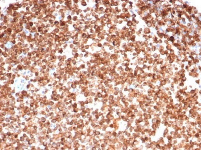 CD74 (B-Cell Marker) (Transcription Regulator) Antibody in Immunohistochemistry (Paraffin) (IHC (P))