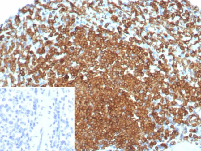 CD74 (B-Cell Marker) (Transcription Regulator) Antibody in Immunohistochemistry (Paraffin) (IHC (P))