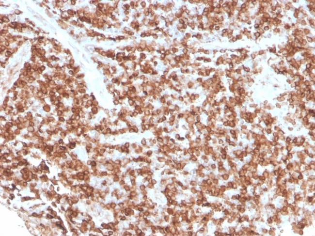 CD74 Antibody in Immunohistochemistry (Paraffin) (IHC (P))