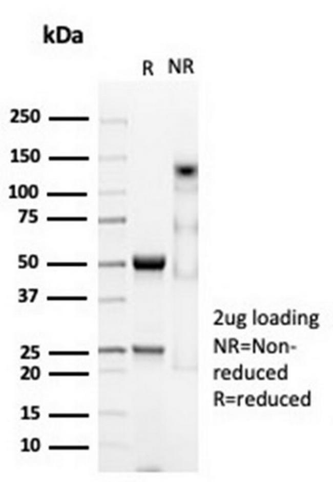 CD74 (B-Cell Marker) Antibody in SDS-PAGE (SDS-PAGE)