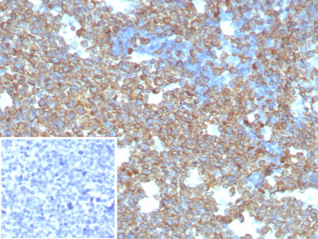 CD74 (B-Cell Marker) (Transcription Regulator) Antibody in Immunohistochemistry (Paraffin) (IHC (P))