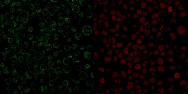 CD79a (B-Cell Marker) Antibody in Immunocytochemistry (ICC/IF)