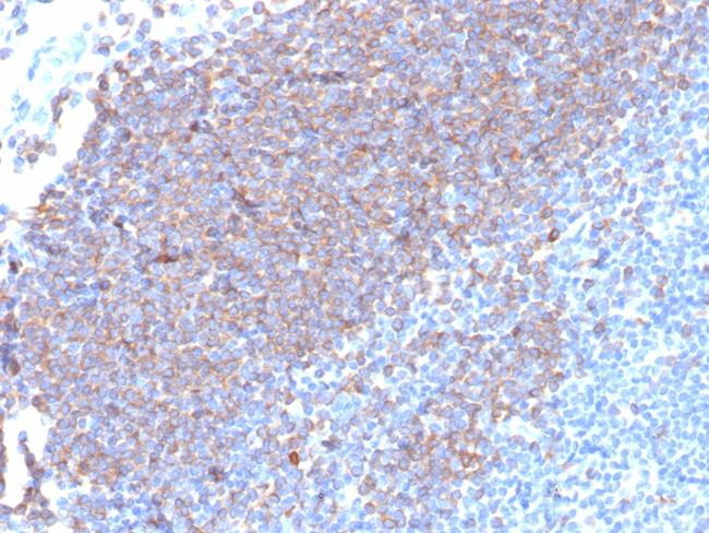 CD79a (B-Cell Marker) Antibody in Immunohistochemistry (Paraffin) (IHC (P))