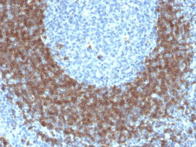 CD79b Antibody in Immunohistochemistry (Paraffin) (IHC (P))