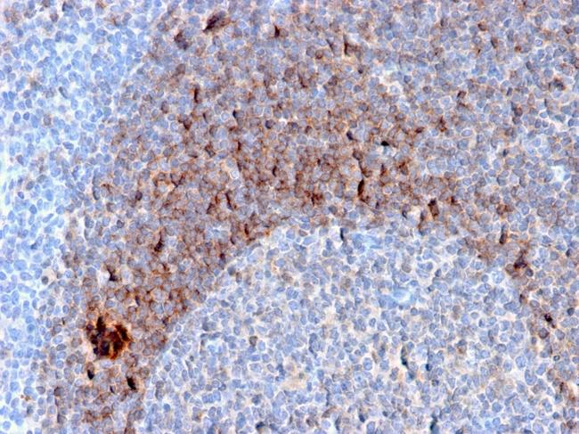 CD79b (B-Cell Marker) Antibody in Immunohistochemistry (Paraffin) (IHC (P))