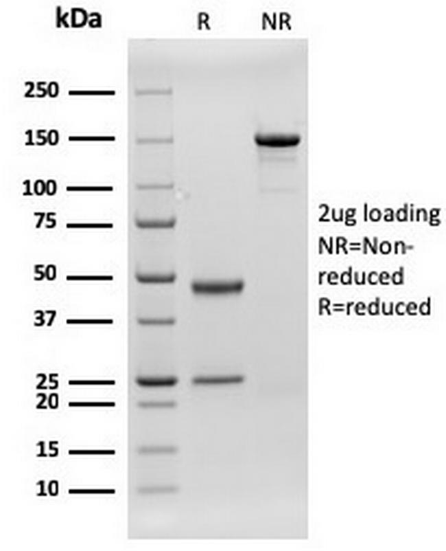 CD79b (B-Cell Marker) Antibody in SDS-PAGE (SDS-PAGE)