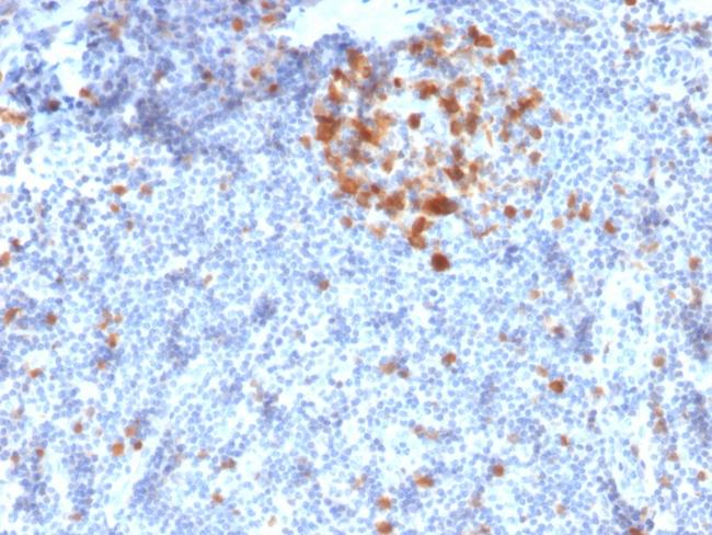 Cdk1/p34cdc2 Serine-Threonine Kinase Antibody in Immunohistochemistry (Paraffin) (IHC (P))