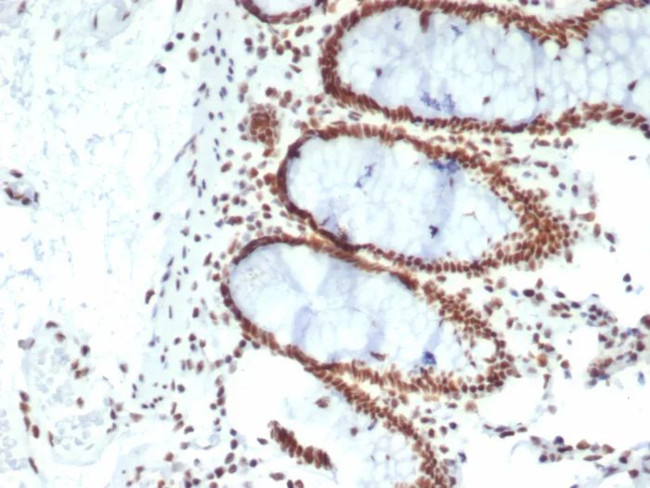 CDC5L Antibody in Immunohistochemistry (Paraffin) (IHC (P))