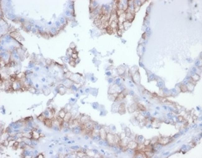 Cdc20 (Cell Division Cycle Protein 20) Antibody in Immunohistochemistry (Paraffin) (IHC (P))