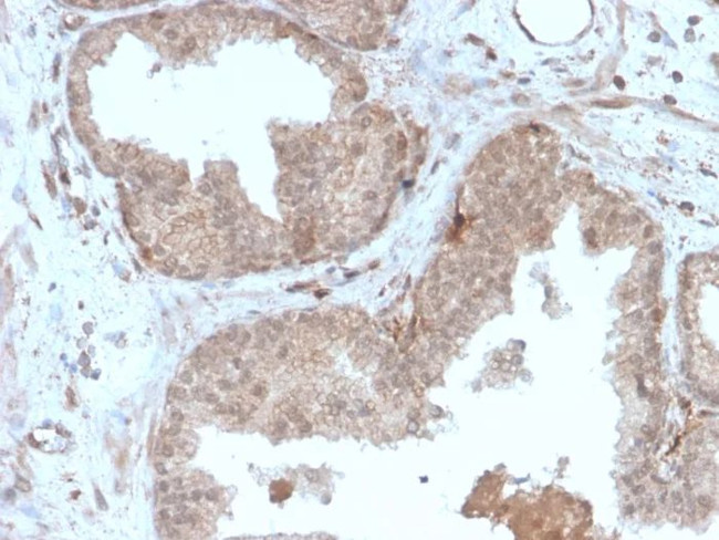 Major Vault Protein (MVP) Antibody in Immunohistochemistry (Paraffin) (IHC (P))