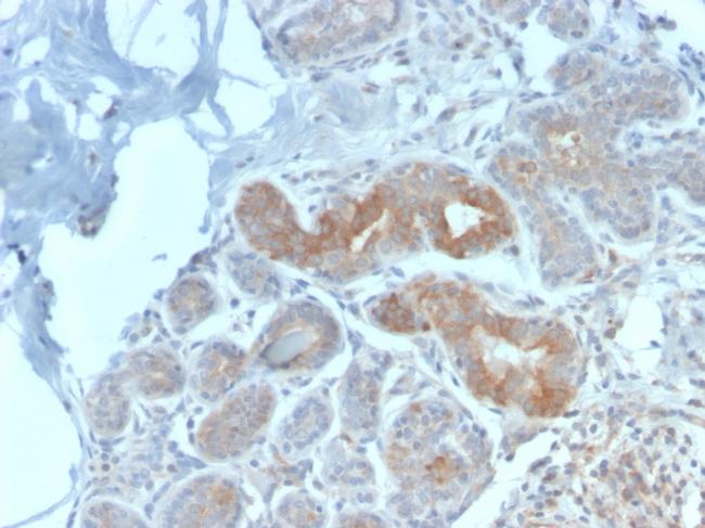 Major Vault Protein (MVP) Antibody in Immunohistochemistry (Paraffin) (IHC (P))