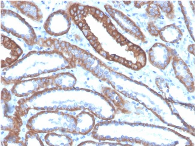 E-Cadherin (CDH1)/CD324 Antibody in Immunohistochemistry (Paraffin) (IHC (P))