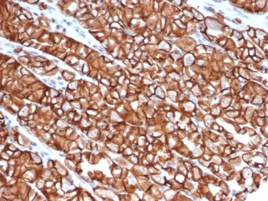 E-Cadherin (CDH1)/CD324 (Intercellular Junction Marker) Antibody in Immunohistochemistry (Paraffin) (IHC (P))