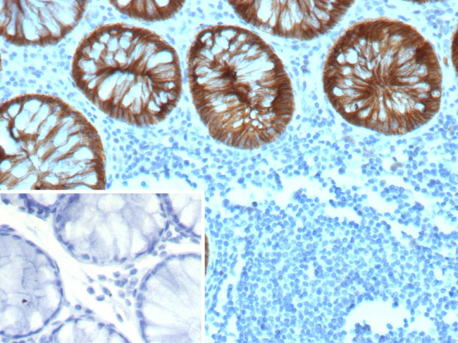 E-Cadherin (CDH1)/CD324 (Intercellular Junction Marker) Antibody in Immunohistochemistry (Paraffin) (IHC (P))