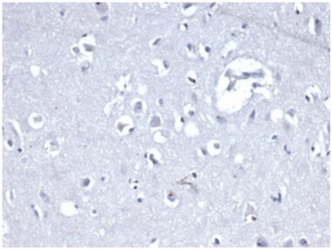 E-Cadherin (CDH1)/CD324 Antibody in Immunohistochemistry (Paraffin) (IHC (P))