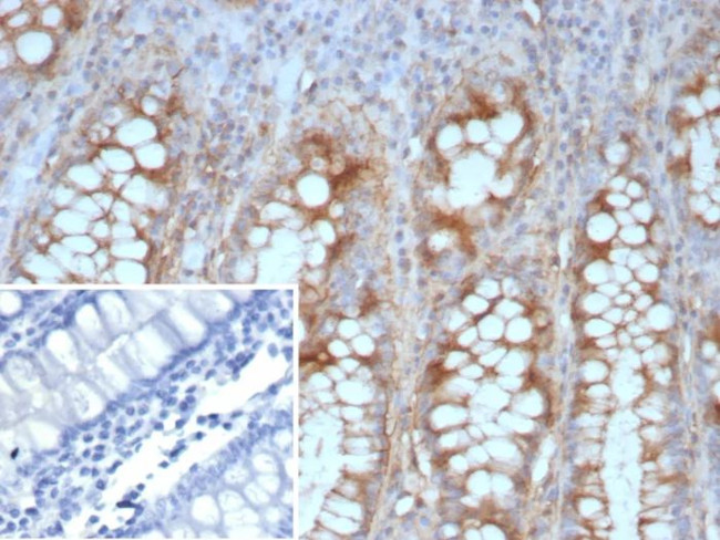 E-Cadherin (CDH1)/CD324 (Intercellular Junction Marker) Antibody in Immunohistochemistry (Paraffin) (IHC (P))