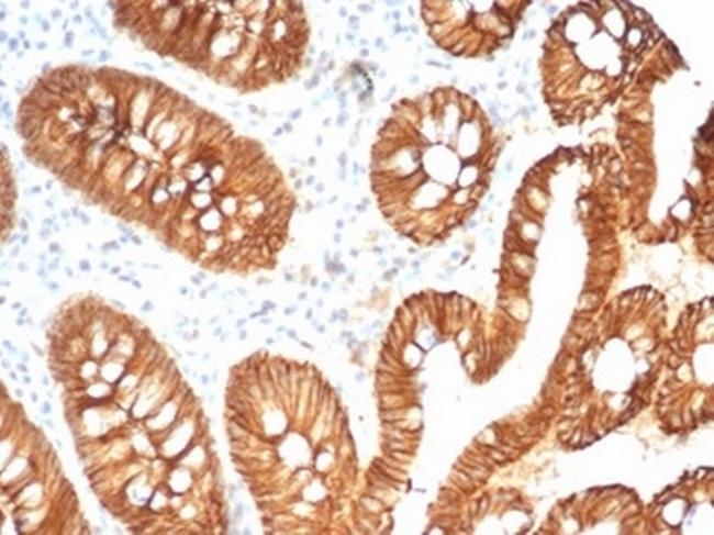 E-Cadherin (CDH1)/CD324 (Intercellular Junction Marker) Antibody in Immunohistochemistry (Paraffin) (IHC (P))