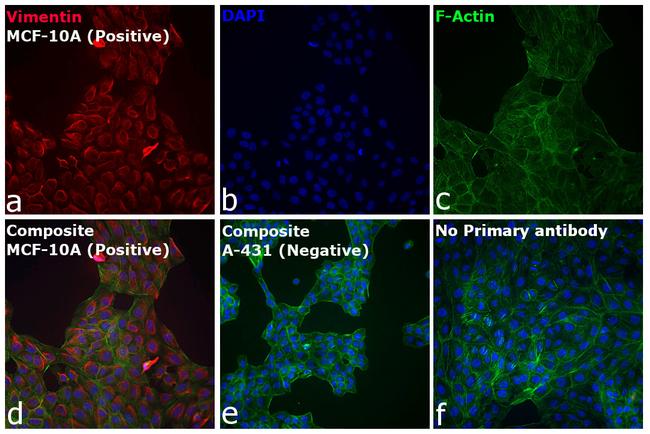 Rabbit IgG (H+L) Cross-Adsorbed Secondary Antibody in Immunocytochemistry (ICC/IF)