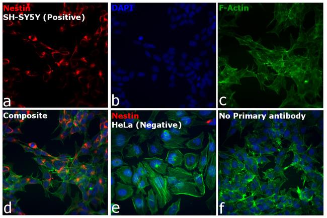 Mouse IgG (H+L) Cross-Adsorbed Secondary Antibody in Immunocytochemistry (ICC/IF)