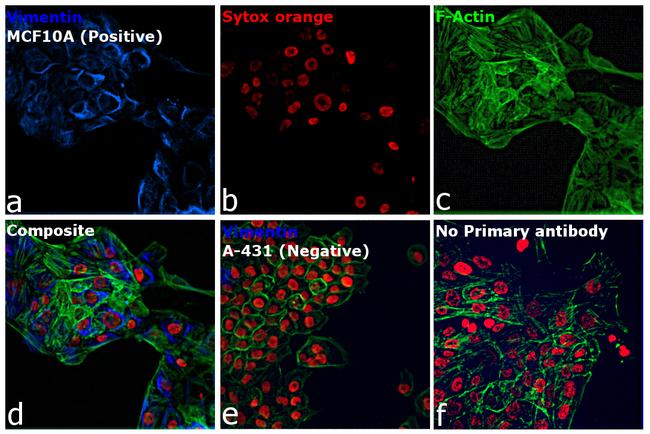 Rabbit IgG (H+L) Cross-Adsorbed Secondary Antibody in Immunocytochemistry (ICC/IF)