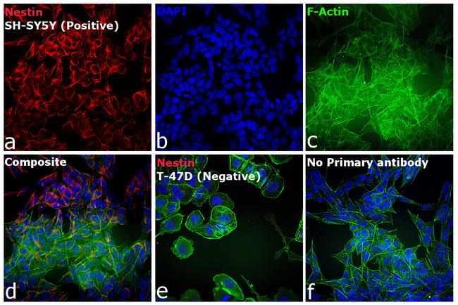 Mouse IgG (H+L) Cross-Adsorbed Secondary Antibody in Immunocytochemistry (ICC/IF)